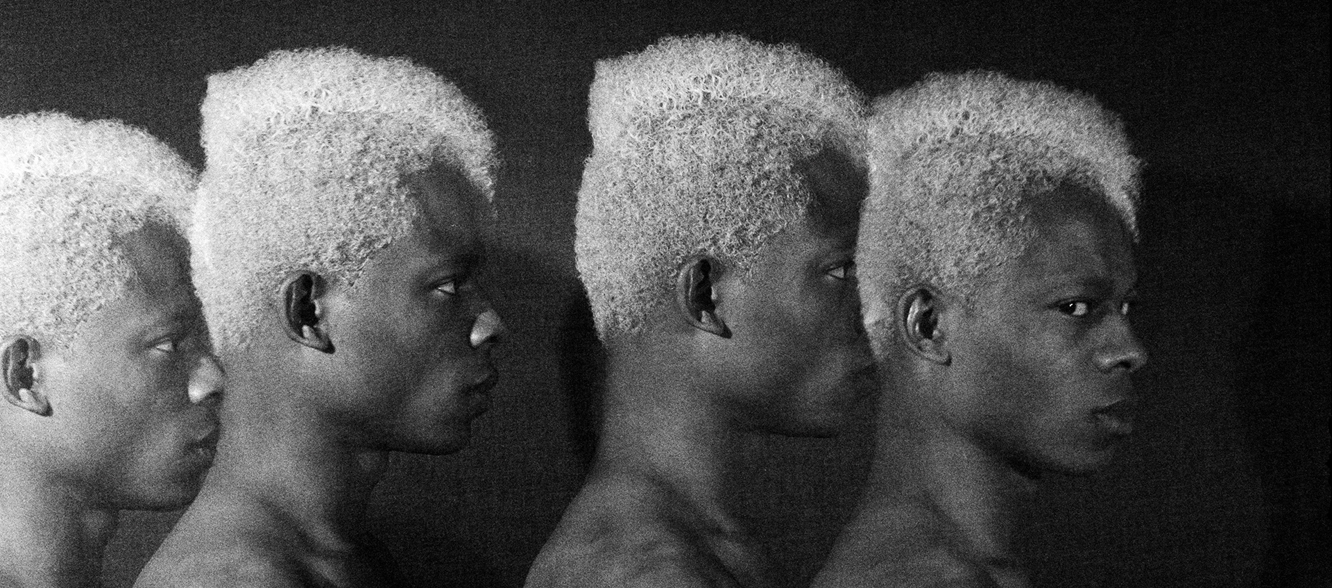 Photographic montage of repeated profile views of a young black male with white hair. In three he stares ahead; in the fourth he looks sideways at the camera.
